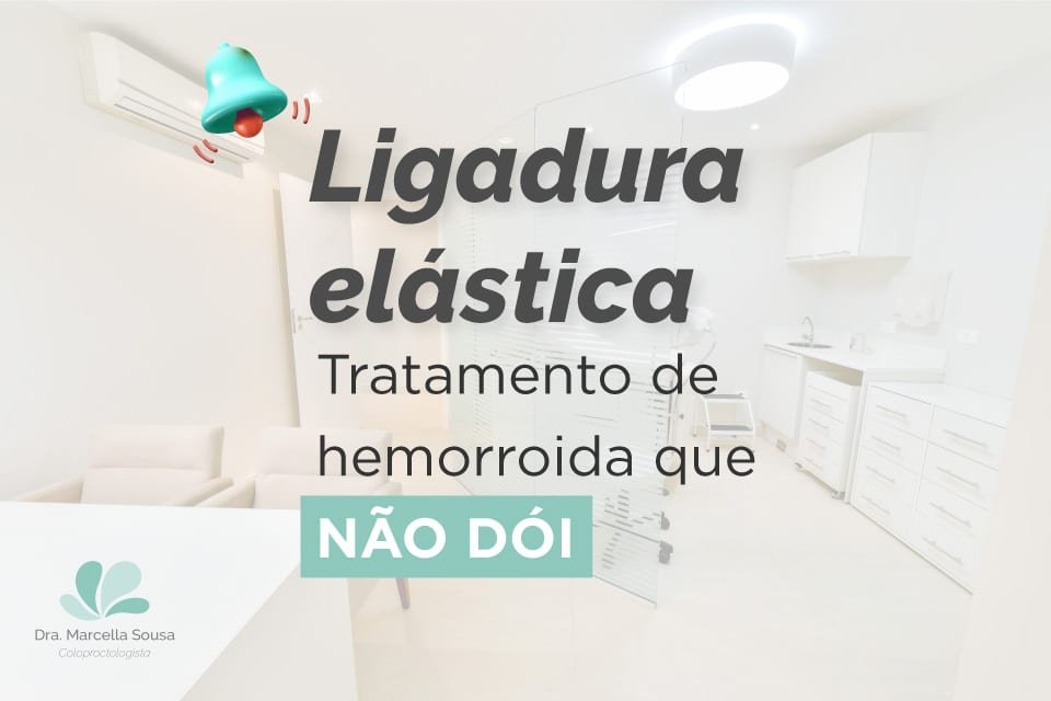 Ligadura Elástica para Hemorroidas Tratamento sem Cirurgia