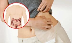 colostomia-indicacoes