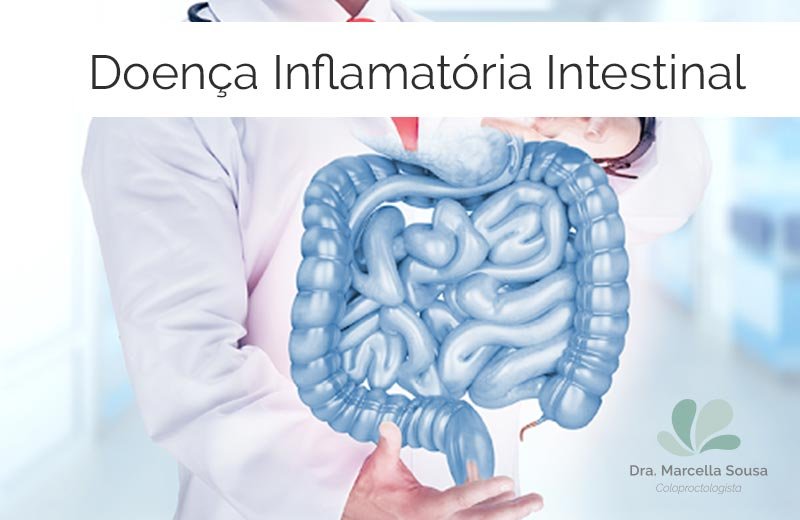 O Que São Doenças Inflamatórias Intestinais Dra Marcella Sousa 8566