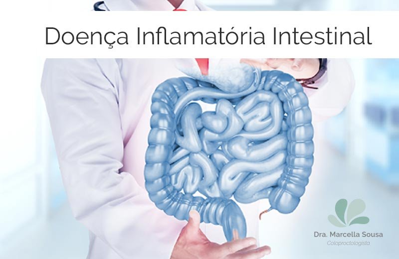 O Que São Doenças Inflamatórias Intestinais Dra Marcella Sousa 