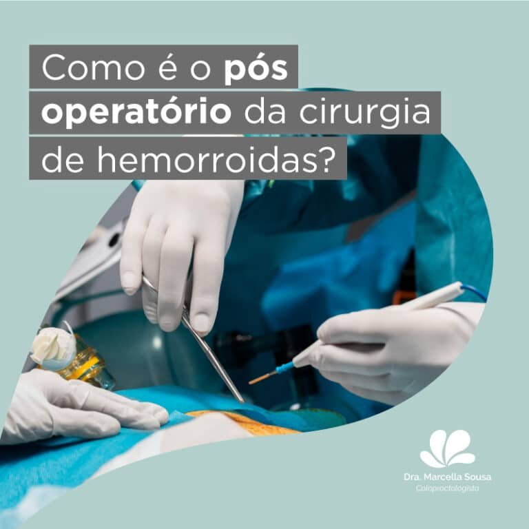 Como é O Pós Operatório Da Cirurgia De Hemorroidas - Dra Marcella Sousa