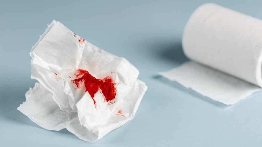 sangue-vivo-nas-fezes