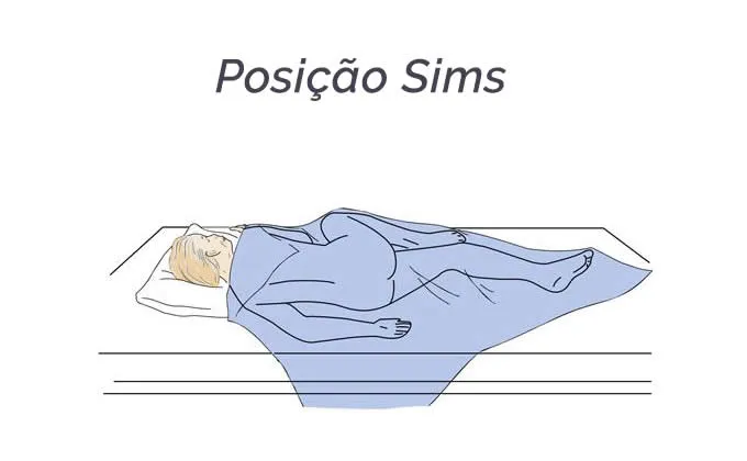 posicao-sims-para-exames-coloproctologia