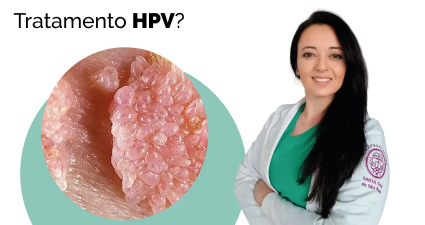 como-e-tratamento-hpv