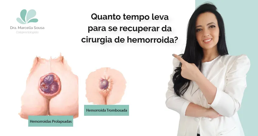 recuperacao-cirurgia-hemorroida